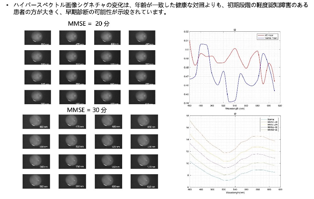 眼底ハイパースペクトルカメラ